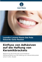 Einfluss von Adhäsiven auf die Haftung von Keramikbrackets (German Edition) 6206964736 Book Cover
