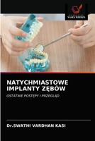Natychmiastowe Implanty ZĘbów 6203609234 Book Cover