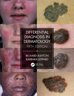 Differential Diagnosis in Dermatology 0397583133 Book Cover