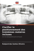 Clarifier le positionnement des troisièmes molaires incluses (French Edition) 620721711X Book Cover