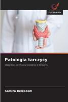 Patologia tarczycy (Polish Edition) 6209807275 Book Cover
