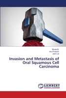 Invasion and Metastasis of Oral Squamous Cell Carcinoma 6203464597 Book Cover