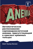 Автоматическое распознавание серповидноклеточной анемии, присутствующей в красных кровяных тельцах 6205918854 Book Cover