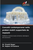 Concetti contemporanei nelle protesi mobili supportate da impianti (Italian Edition) 6630273281 Book Cover