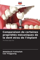 Comparaison de certaines propriétés mécaniques de la dent et/ou de l'implant (French Edition) 6207194063 Book Cover