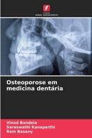 Osteoporose em medicina dentária (Portuguese Edition) 6208054737 Book Cover
