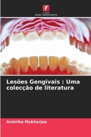 Lesões Gengivais: Uma colecção de literatura (Portuguese Edition) 6205428741 Book Cover