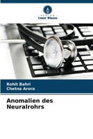 Anomalien des Neuralrohrs 6630201787 Book Cover