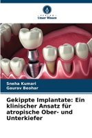 Gekippte Implantate: Ein klinischer Ansatz für atropische Ober- und Unterkiefer (German Edition) 6206903710 Book Cover