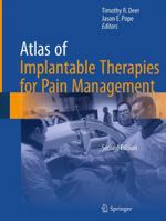 Atlas of Implantable Therapies for Pain Management 1493939491 Book Cover