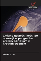Zmiany gestosci kosci po operacji w przypadku protezy MiniHip(TM) z krótkim trzonem (Polish Edition) 6206818764 Book Cover