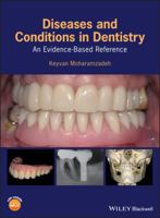 Diseases and Conditions in Dentistry: An Evidence-Based Reference 1119312035 Book Cover