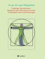 Unnötige Operationen - Beispiele und Alternativen in der Orthopädie und Unfallchirurgie 3347258487 Book Cover