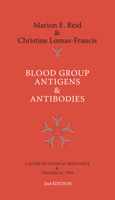 Blood Group Antigens & Antibodies: A Guide to Clinical Relevance & Technical Tips 1595728163 Book Cover