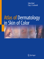 Atlas of Dermatology in Skin of Color 3032210569 Book Cover