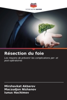 Résection du foie: Les moyens de prévenir les complications per- et post-opératoires (French Edition) 620508693X Book Cover