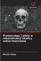 Przeszczepy i platy w rekonstrukcji okolicy ustno-twarzowej (Polish Edition) 6630180860 Book Cover