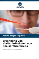 Erkennung von Vorläuferläsionen von Speiseröhrenkrebs 6207328701 Book Cover