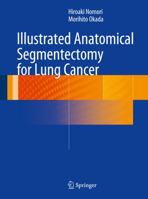 Illustrated Anatomical Segmentectomy for Lung Cancer 4431541438 Book Cover