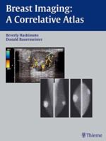 Breast Imaging: A Correlative Atlas 3131319518 Book Cover