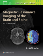 Magnetic Resonance Imaging of the Brain and Spine 078176985X Book Cover