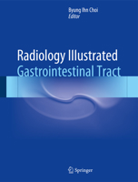 Radiology Illustrated: Gastrointestinal Tract 3642554113 Book Cover