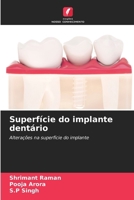 Superfície do implante dentário (Portuguese Edition) 6630309316 Book Cover