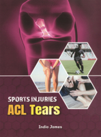 ACL Tears (Sports Injuries) B0GMZKKP54 Book Cover