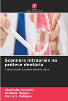 Scanners intraorais na prótese dentária (Portuguese Edition) 6630280016 Book Cover