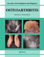 Oesteoarthritis: An Atlas of Investigation and Diagnosis 1904392164 Book Cover
