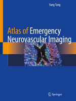 Atlas of Emergency Neurovascular Imaging 3030436535 Book Cover