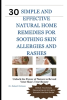 30 SIMPLE AND EFFECTIVE NATURAL HOME REMEDIES FOR SOOTHING SKIN ALLERGIES AND RASHES: Unlock the Power of Nature to Reveal Your Skin's True Beauty B0CQ7X3DTB Book Cover