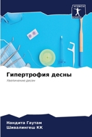 Гипертрофия десны: Увеличение десен 6204135392 Book Cover