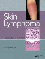 Skin Lymphoma: The Illustrated Guide 1118492498 Book Cover