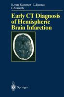 Early CT Diagnosis of Hemispheric Brain Infarction 3540600566 Book Cover