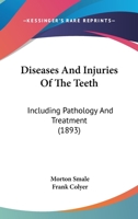 Diseases And Injuries Of The Teeth: Including Pathology And Treatment 1166485358 Book Cover