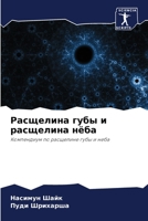 Расщелина губы и расщелина нёба: Компендиум по расщелине губы и неба 6205999048 Book Cover