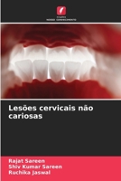 Lesões cervicais não cariosas (Portuguese Edition) 6630260430 Book Cover