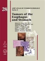 Tumors of the Esophagus and Stomach 1933477407 Book Cover
