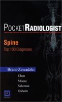 PocketRadiologist - Spine: Top 100 Diagnoses (PocketRadiologist) 072160675X Book Cover