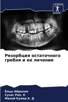 Резорбция остаточного гребня и ее лечение 6204130412 Book Cover