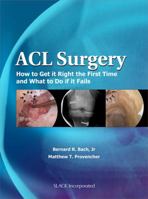 ACL Surgery: How To Get It Right the First Time and What To Do if it Fails 1556428952 Book Cover