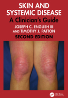 Skin and Systemic Disease: A Clinician's Guide 1032762810 Book Cover
