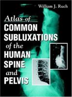 Atlas of Common Subluxations of the Human Spine and Pelvis 084933117X Book Cover