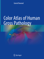 Color Atlas of Human Gross Pathology 3030913147 Book Cover
