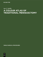 A Colour Atlas of Traditional Meniscectomy 3112419936 Book Cover