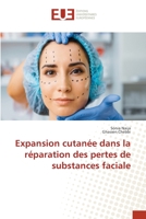 Expansion cutanée dans la réparation des pertes de substances faciale 6203426148 Book Cover