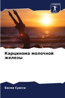 Карцинома молочной железы 6206087808 Book Cover