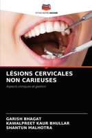 LÉSIONS CERVICALES NON CARIEUSES: Aspects cliniques et gestion 6204079786 Book Cover