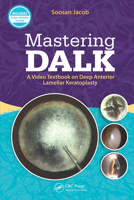 Mastering DALK: A Video Textbook on Deep Anterior Lamellar Keratoplasty 1630914568 Book Cover